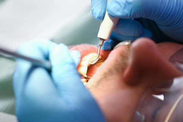 Best Dental Abscess Treatment in Cvallis, OR